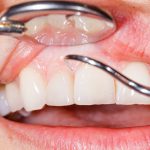 Curso del Dr. David González en d19 Madrid | Clínica Dental Ortoperio