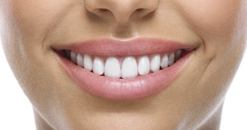 Estética dental 5
