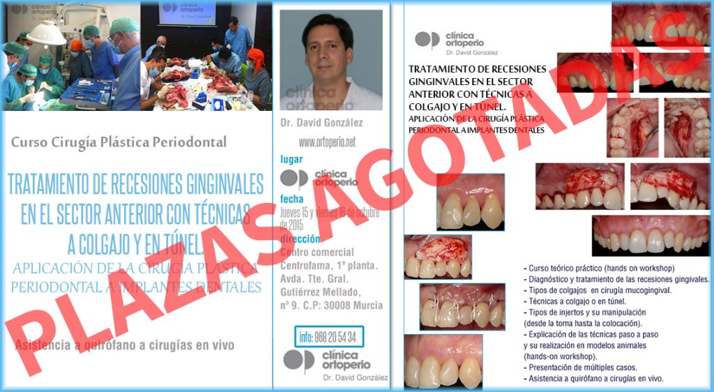 Curso de Cirugía Plástica Periodontal. Plazas agotadas | Clínica Dental Ortoperio