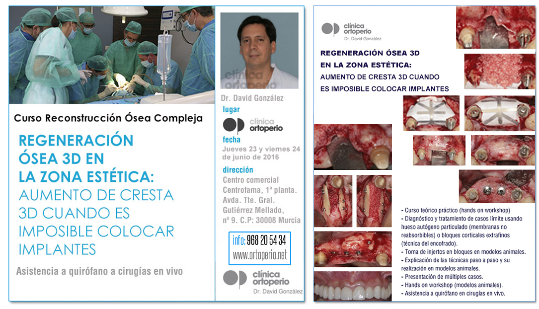 Curso Regeneración Ósea 3D impartido por el Dr. David González (2016) | Clínica Dental Ortoperio