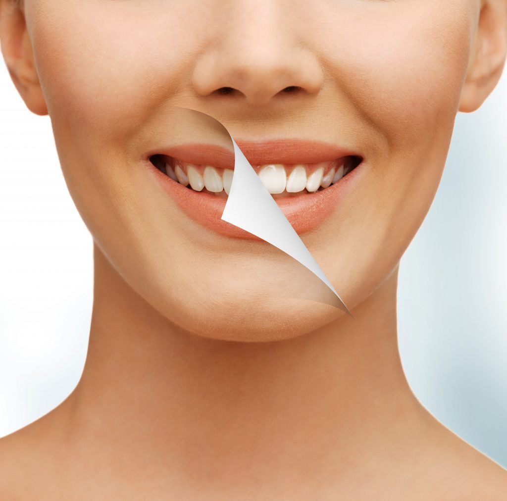 ¿Estás buscando clínica para un blanqueamiento dental en Murcia? | Clínica Dental Ortoperio