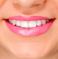 Coronas (“Fundas”) sobre dientes e implantes. 1
