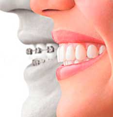 Orthodontics 2