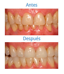 Estética Dental|Clínica Dental Ortoperio