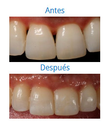 Dental Aesthetics|Clínica Dental Ortoperio
