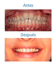 orthodontics|Clínica Dental Ortoperio
