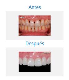 Periodontics|Clínica Dental Ortoperio