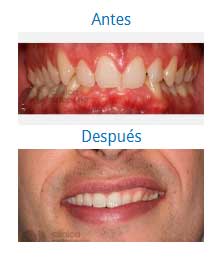 Ortodoncia|Clínica Dental Ortoperio
