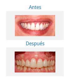 Periodoncia|Clínica Dental Ortoperio