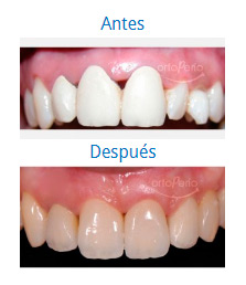 Multidisciplinary Cases|Clínica Dental Ortoperio