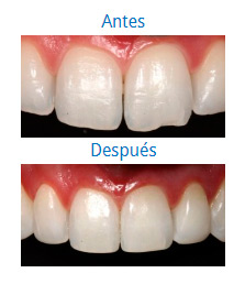 Dental Aesthetics 5
