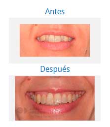 Ortodoncia|Clínica Dental Ortoperio