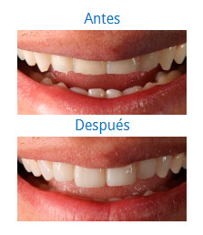 Dental Aesthetics 6