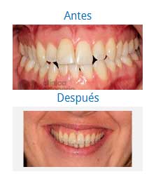 Orthodontics 7