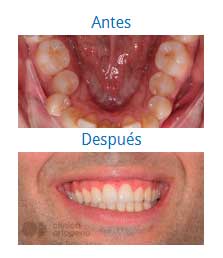 Orthodontics|Clínica Dental Ortoperio