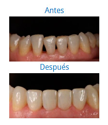 Dental Aesthetics 8