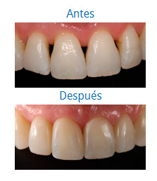 Estética Dental|Clínica Dental Ortoperio