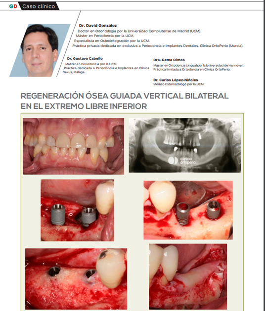 Publicaciones científicas|Clínica Dental Ortoperio