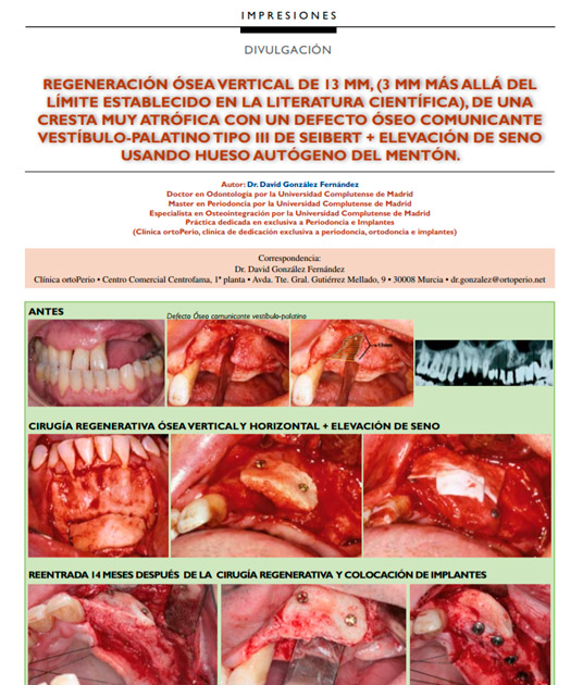 Publicaciones científicas|Clínica Dental Ortoperio