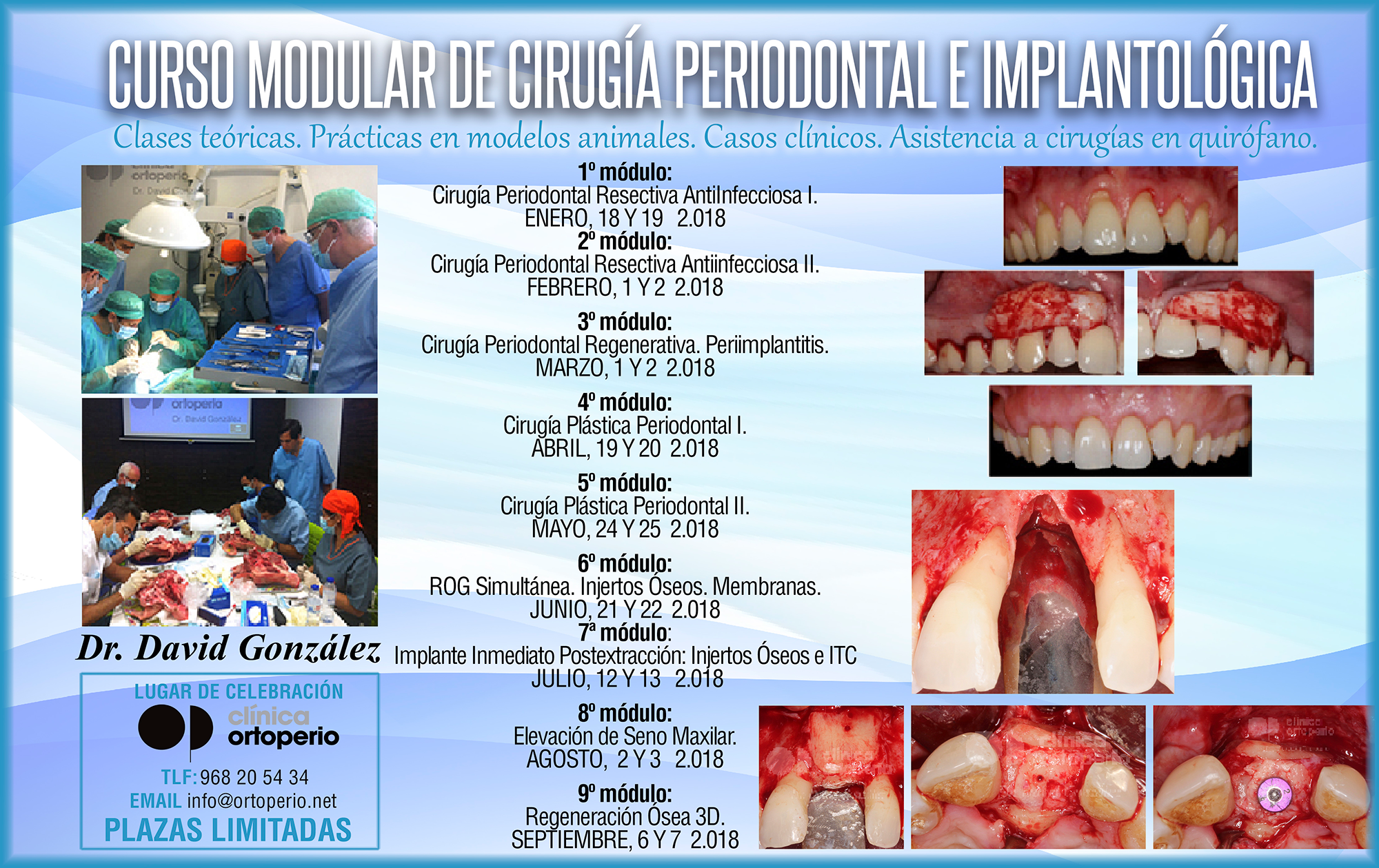Curso Modular de Cirugía Periodontal e Implantológica|Clínica Dental Ortoperio