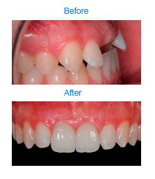 Multidisciplinary Cases|Clínica Dental Ortoperio