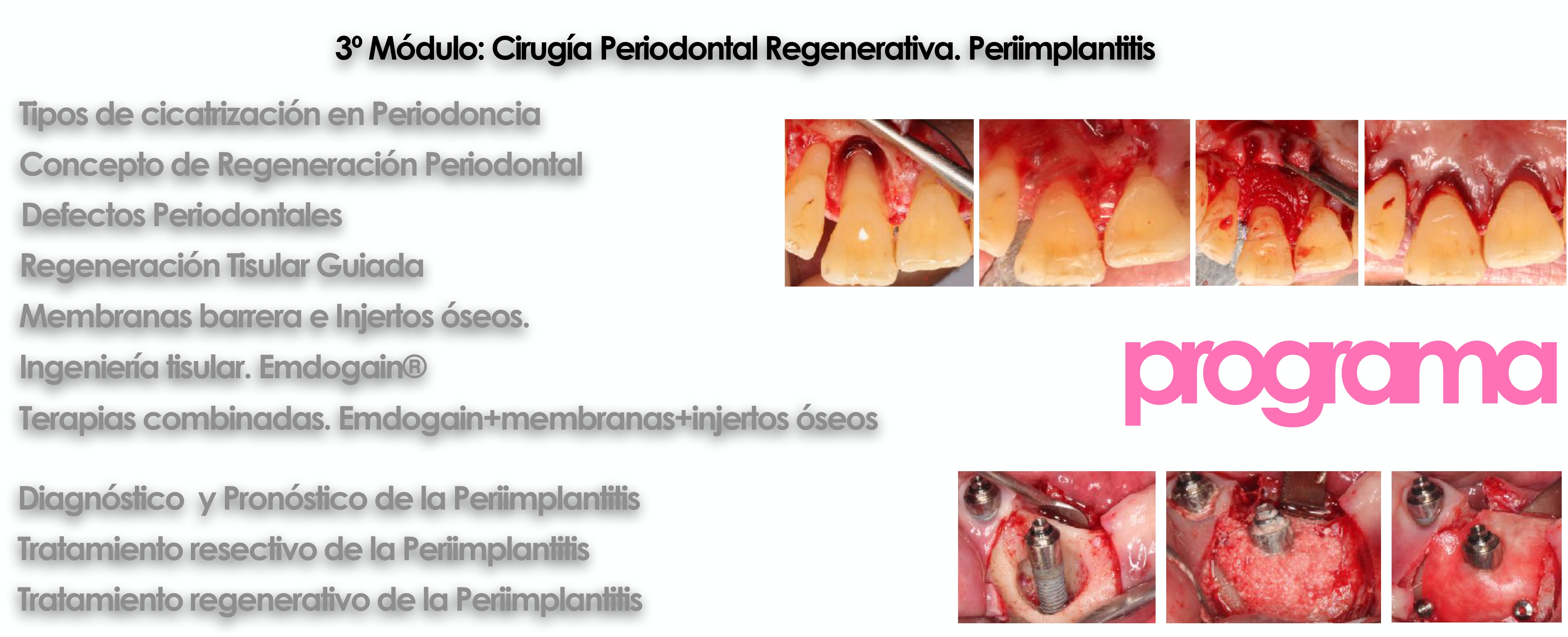 Curso cirugía periodontal e implantológica 18