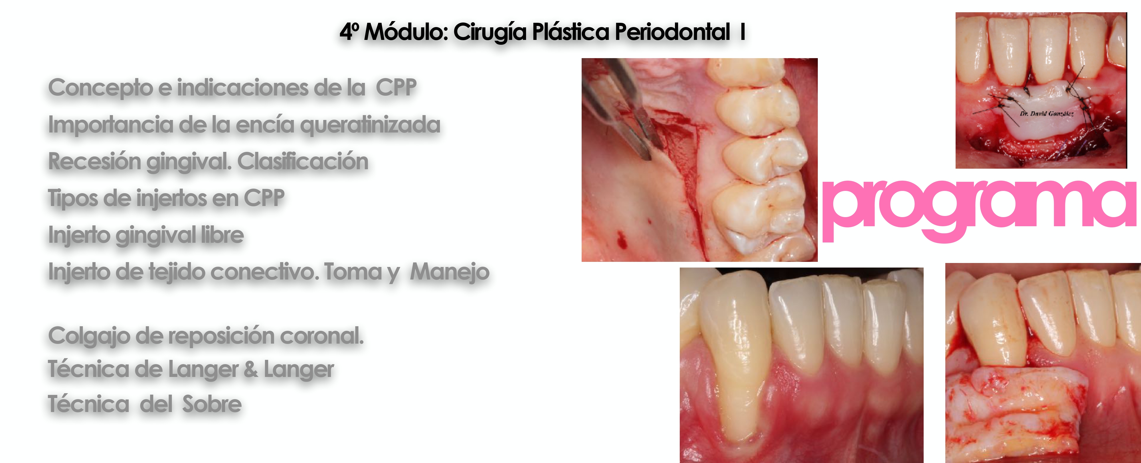 Curso cirugía periodontal e implantológica 19
