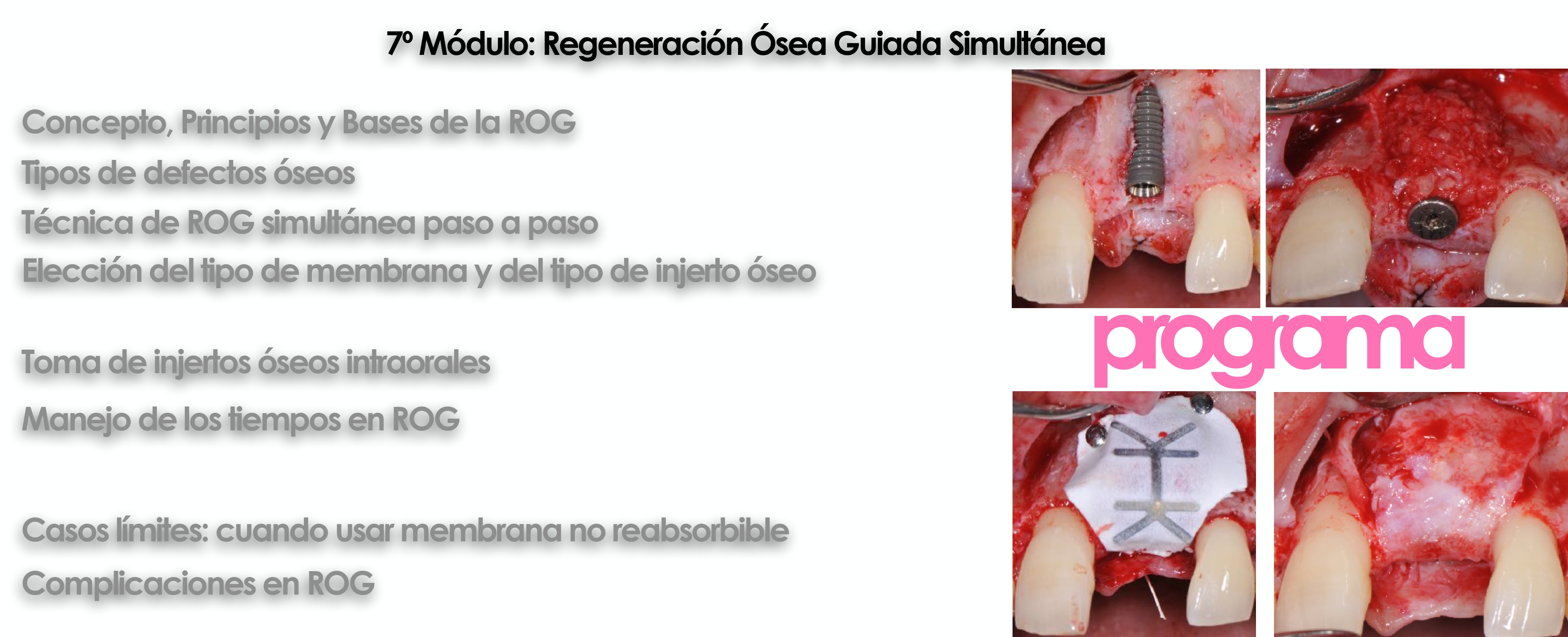 Curso cirugía periodontal e implantológica 11