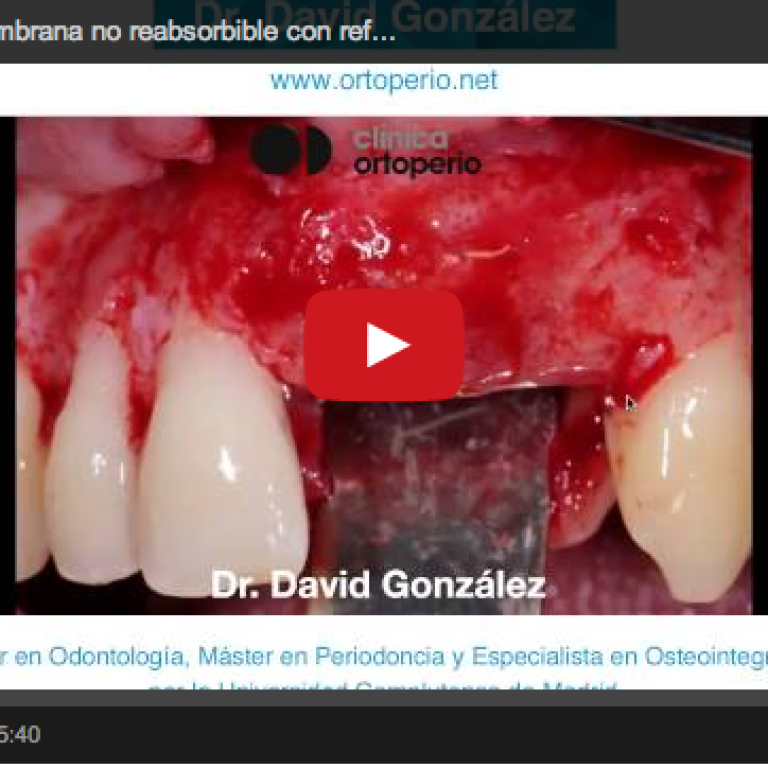 Captura de pantalla 2014-07-22 a la(s) 11.53.10