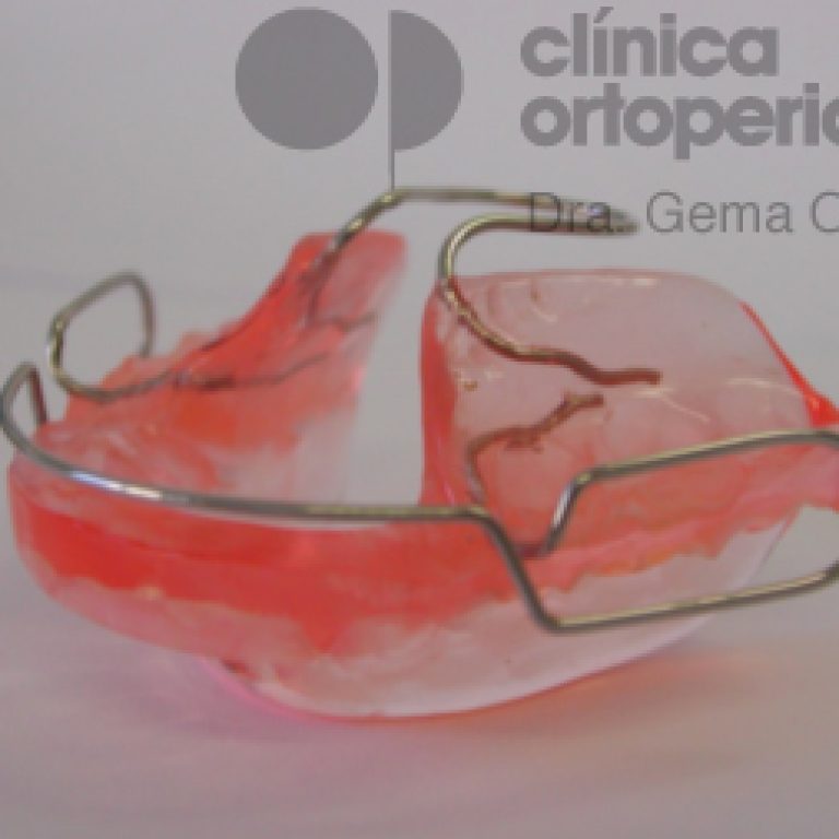 aparato-crecimiento-mandibula-y-maxilar