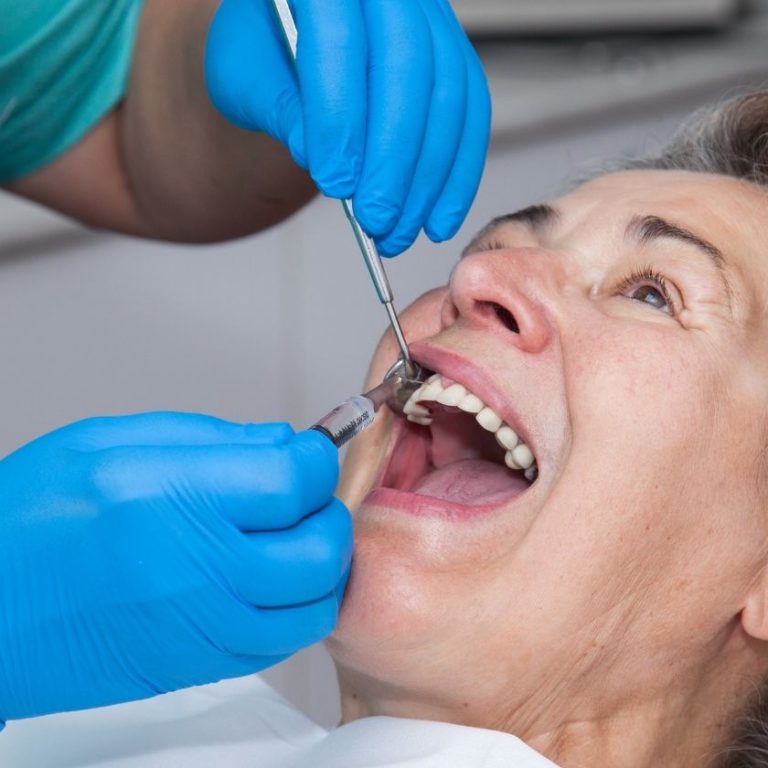 recesion gingival ortoperio