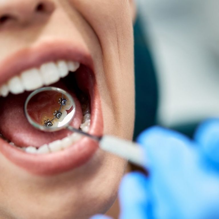 especialista ortodoncia murcia