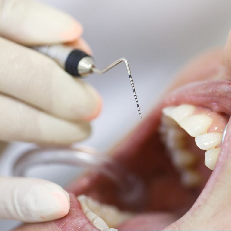 periodoncia ortoperio murcia